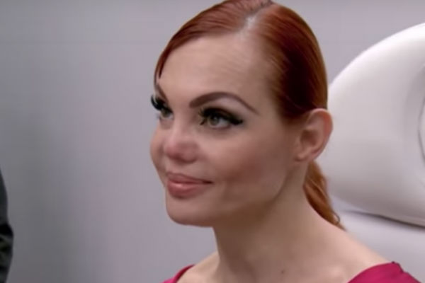 La ex modelo ha tratado varias veces de reconstruir su nariz.
Foto: Youtube