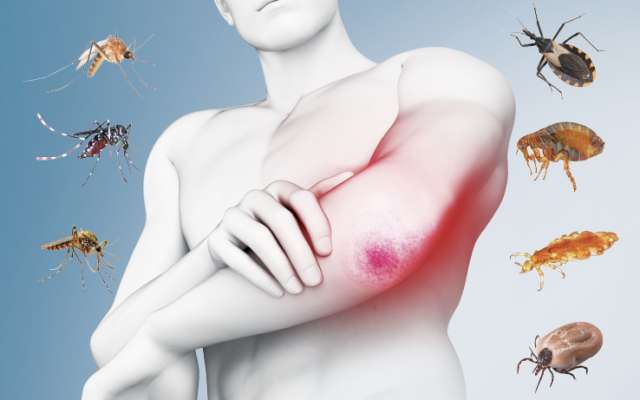 LYME. Es una infección bacteriana transmitida por las garrapatas. Infografía: Miguel Ulloa